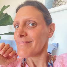 Leila's Eczema • Facebook