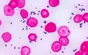 Image result for Corynebacterium