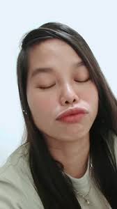 Natusok Na Babae Habang Nag Papabakuna