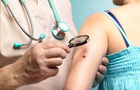 Melanoma surgery, melanoma, hyperhidrosis, skin cancer, skin tumor, merkel cell carcinoma. The Different Types Of Skin Cancer Biopsies