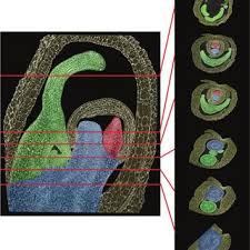 Image result for Hypolytrum heteromorphum