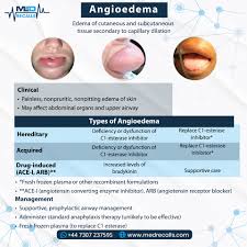 Image result for Angioedema