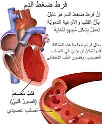 Ø§Ù„Ø¯Ù†ÙŠØ³ Ø§Ù„Ø¨Ø­Ø± Ø§Ù„Ù„Ø§Ø¬Ø¦ÙŠÙ† Ù…Ø®ØªÙ„Ù Ù…Ø¹Ø§Ø¯Ù„Ø© Ø¶ØºØ· Ø§Ù„Ø¯Ù… Dsvdedommel Com