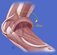 Image result for Laggera gracilis