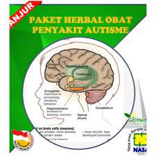 99 in 2017, researchers at duke university published a phase i safety trial evaluating autologous cord blood in children with autism. Paket Obat Herbal Autisme Ori Nasa Jakarta Shopee Indonesia