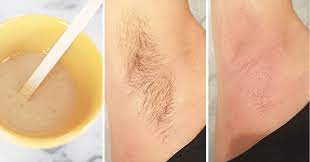 Make sure to exfoliate between visits and ask a waxing specialist to recommend products to treat and prevent ingrown hairs. Best Way To Get Rid Of Underarm Hair At Home