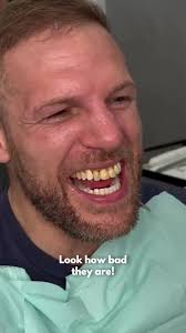 Hats off to all the staff @royalwharfdental for pulling this absolute  blinder