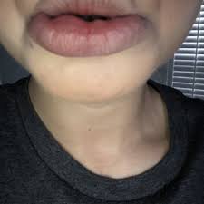 We would like to show you a description here but the site won’t allow us. Mirza Aesthetics Cedar Grove 20 Photos 19 Reviews Tattoo Removal 870 Pompton Ave Cedar Grove Nj Phone Number Yelp