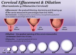 Cervical Dilation Charts Cervical Dilation Chart Student Midwife Birth Doula