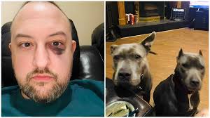 Rescued pit bulls saved their owner's life