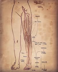 Las trombosis en las arterias generalmente surgen en lugares con una pared vascular interna alterada ( túnica íntima o íntima ), p. Isquemia Arterial Periferica Dr Augusto Saldana M Lachuletadeosler Com Trombosis Venosa Profunda Trombosis Venosa Trombosis