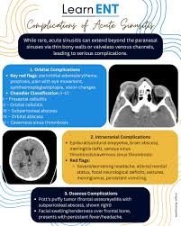 Image result for Sinusitis Prediction Rule