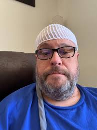 Is Optune's hassle worth the decrease in quality of life?