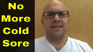 Cold sores are not only painful but ugly. How To Get Rid Of A Cold Sore Overnight Youtube