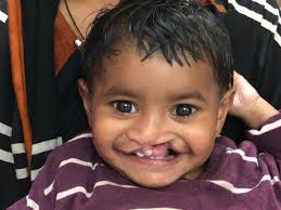 Fundraiser for shahid aziz by Nafis Rahman : Give the Gift of a Smile Back:  Smile Bangladesh