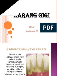 Menghilangkan karang gigi memang agak sulit, apalagi karang gigi yang membandel dan karena adanya beberapa faktor yang mempengaruhi karang karang gigi juga dapat dibersihkan, apalagi dengan menggunakan cara alami yang sehat yang aman bagi kesehatan mulut dan gigi pastinya. Karang Gigi