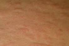 Image result for Wheal