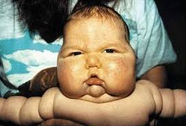 Weird Diseases That You Hardly Know ( Not for weak-hearten people )