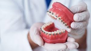 Dentes Tortos Conheca Tres Opcoes De Tratamento Dental Arte