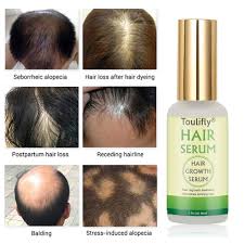 Regrowing your hair is not easy, but it is possible. Hair Growth Serum Anti Hair Loss Serum For Thickening And Regrowing Thinning Hair For Fast Hair Growth Amazon De Beauty
