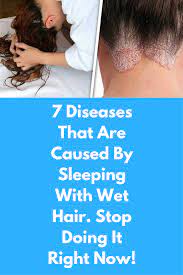 7 Diseases That Are Caused By Sleeping With Wet Hair Stop Doing It Right Now Is It Bad To Sleep With Wet H Wet Hair Sleeping With Wet Hair Wet Hair Overnight