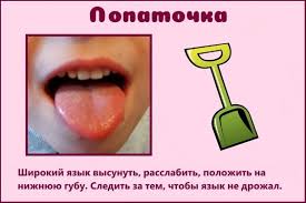 артикуляционная гимнастика в стихах для детей 3 4 лет Artikulyacionnaya Gimnastika Pri Dizartrii V Kartinkah Gimnastika Logopedicheskie Igry Logopediya