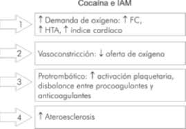 1 infarto agudo al miocardio dr. Fisiopatologia Del Infarto Agudo Del Miocardio En Presencia De Cocaina Download Scientific Diagram