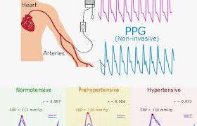 New China And Us Studies Back Use Of Pulse Oximeters For