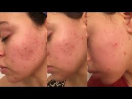 Bethanie Michelle Statler