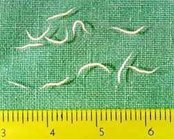Chez la fillette, on observe parfois. Eliminer Les Vers Intestinaux Par Les Voies Naturelles Remedes De Grand Mere Vers Intestinaux Remedes Naturels Remede De Grand Mere
