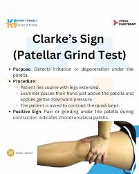 Image result for Patellar Apprehension Test