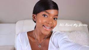 How to get braces for free in south africa. Braces Cost In South Africa 2021 Newshub360 Net