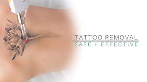 Laser tattoo removal began in the 1960s, when the first reported experiments into the effects of lasers on tattoos took place. Laser Tattoo Removal Remove Unwanted Ink