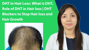 Although genetics is the main contributing factor for increased dht production in the body, your lifestyle and diet regimen also has a significant impact on dht production. Dht In Hair Loss What Is Dht Role Of Dht In Hair Loss Dht Blockers To Stop Hair Loss Youtube