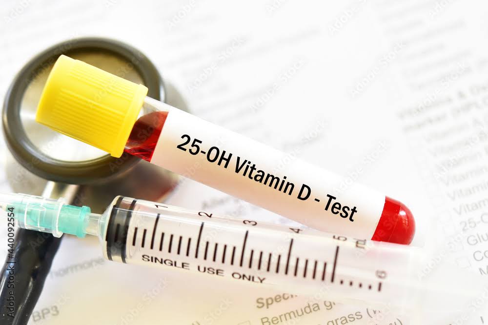 VITAMIN D 25 HYDROXY (D2+D3) product image