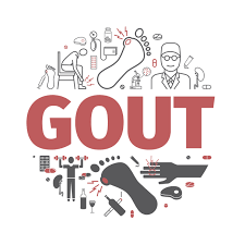 High Uric Acid Or Gout Causes Prevention And Treatment