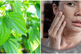 Khasiat daun sirih merah juga tak kalah hebat dari daun sirih hijau yang biasa. 12 Manfaat Daun Sirih Untuk Kecantikan Mencegah Jerawat