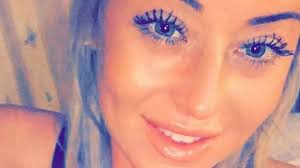 School worker, 31, who lost her sight to diabetes says it's like 'having a  blob of Vaseline over my eyes'