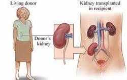 The costs of transplantation in south africa can range anywhere between one and two lakh rands. Best Price Kidney Transplant In India Top Kidney Transplant Hospital India
