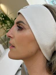 Nose filler aka non- surgical rhinoplasty 💉 Non Surgical Rhinoplasty can  correct the shape, reduce a dorsal hump (bump in the nose) contour,  straighten, lift and more. All without the need for