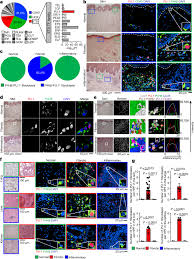 With very simple usage, the program gives you an interesting feeling. Pu 1 Controls Fibroblast Polarization And Tissue Fibrosis Nature