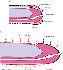 The frenulum can hurt after sex as well. A Flaccid Uncircumcised Penis B Erect Uncircumcised Penis With The Download Scientific Diagram