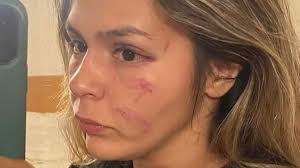 Imane Khelif left rival thanking GOD for escaping horrific injuries in 2022  fight