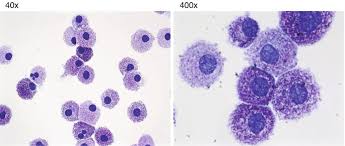 Image result for Mast Cell