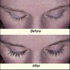 It stretches the timeframe hair remain in the hair growth period. Especially For Women Bauman Medical