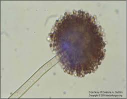 Aspergillus are found in millions in pillows. Archive Aspergillus Niger Not Your Everyday Mold The Fungal Kingdom