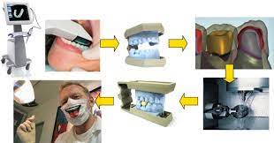 This important tool is used to detect any abnormal formation of oral tissues, which could since this device captures 3d images of the jaw, teeth and tissues in the mouth, it helps our dentist. Recent Advances In Dental Optics Part I 3d Intraoral Scanners For Restorative Dentistry Sciencedirect