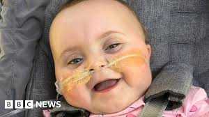 One pound 'miracle-baby' fronts Coventry hospice appeal