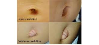 Image result for Umbilicus