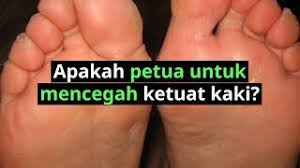 Sekarang jom ketahui 6 jenis ubat batuk yang popular di farmasi farmasi berdekatan anda. Ketuat Kaki Wart Punca Dan Rawatan Menghilangkannya Doctoroncall